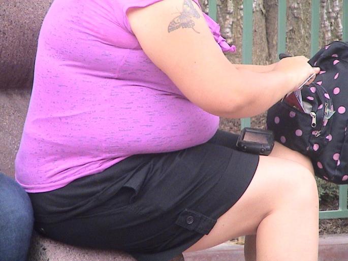 An obese person