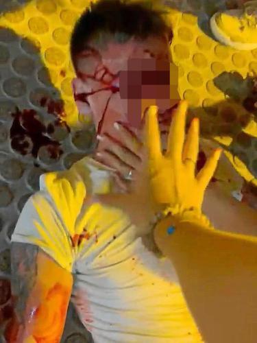 British tourist in Magalluf, Mallorca, left unconscious after a fight